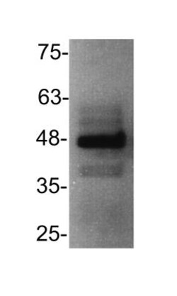CXCR3 Antibody, Novus Biologicals 0.025mg; Unlabeled:Antibodies, Polyclonal