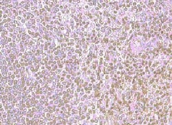 CXCR4 Antibody 0.1 mg; Unconjugated:Antibodies, Polyclonal