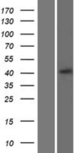 Novus Biologicals&trade;&nbsp;CXCR5 Overexpression Lysate