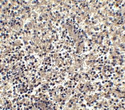 CXCR6 Antibody - BSA Free, Novus Biologicals 0.1mg; Unlabeled:Antibodies,