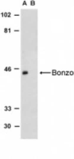 CXCR6 Antibody - BSA Free, Novus Biologicals 0.1mg; Unlabeled:Antibodies,
