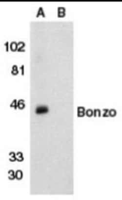Novus Biologicals CXCR6 Antibody Blocking Peptide 0,05 mg | Buy Online | Novus Biologicals&trade; | Fisher Scientific