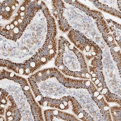 CXorf58 Antibody, Novus Biologicals 0.1mL; Unlabeled:Antibodies, Polyclonal