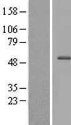 Novus Biologicals&trade;&nbsp;CXorf22 Overexpression Lysate