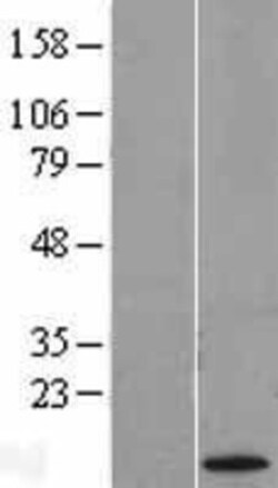Novus Biologicals&trade;&nbsp;CT83 Overexpression Lysate