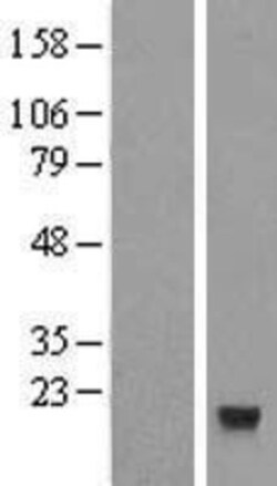 Novus Biologicals&trade;&nbsp;CXX1 Overexpression Lysate