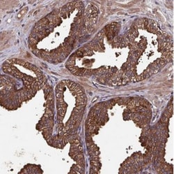 CXXC Finger Protein 11 Antibody, Novus Biologicals 0.1mL; Unlabeled:Antibodies,
