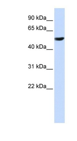 CYB561 Antibody, Novus Biologicals 100&mu;L; Unlabeled:Antibodies, Polyclonal