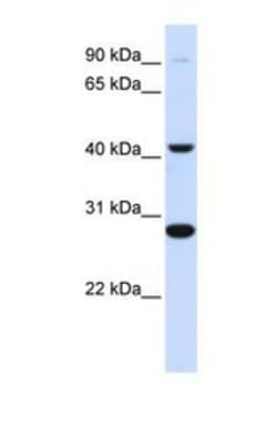 CYB561 Antibody, Novus Biologicals 0.05mg; Unlabeled:Antibodies, Polyclonal