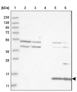 CYB561D1 Antibody, Novus Biologicals 25 &mu;L; Unlabeled:Antibodies, Polyclonal