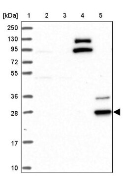 CYB561D2 Antibody, Novus Biologicals 0.1mL; Unlabeled:Antibodies, Polyclonal