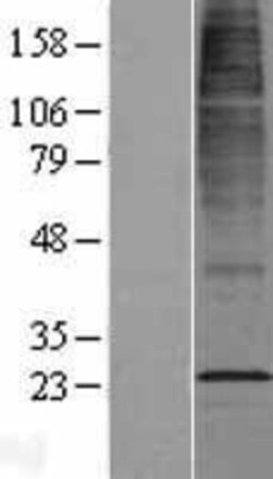 Novus Biologicals&trade;&nbsp;CYB561D2 Overexpression Lysate