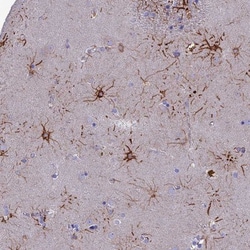 CYB561D2 Antibody, Novus Biologicals 0.1mL; Unlabeled:Antibodies, Polyclonal