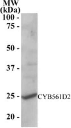CYB561D2 Antibody, Novus Biologicals 0.1mg; Unlabeled:Antibodies, Polyclonal