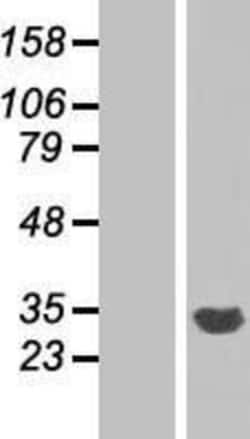 Novus Biologicals&trade;&nbsp;CYB5R2 Overexpression Lysate