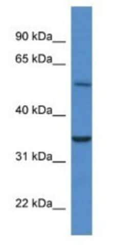 CYB5R4 Antibody, Novus Biologicals 100&mu;L; Unlabeled:Antibodies, Polyclonal