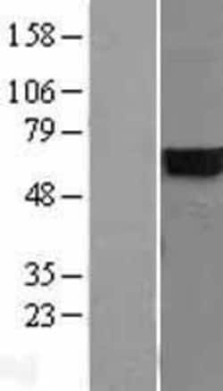 Novus Biologicals&trade;&nbsp;CYB5R4 Overexpression Lysate