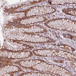 CYB5RL Antibody, Novus Biologicals 0.1mL; Unlabeled:Antibodies, Polyclonal