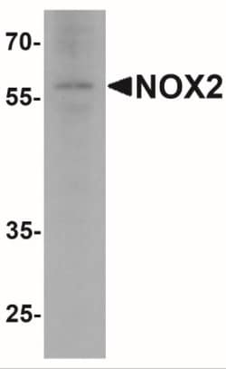 CYBB/NOX2 Antibody - BSA Free, Novus Biologicals:Antibodies:Primary Antibodies
