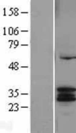 Novus Biologicals&trade;&nbsp;CYC1 Overexpression Lysate
