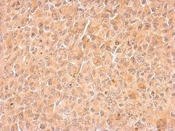 Cyclin B2 Antibody, Novus Biologicals 0.1mg; Unlabeled:Antibodies, Polyclonal