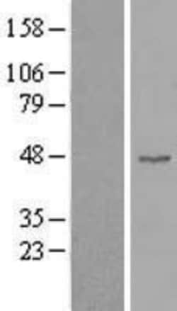 Novus Biologicals&trade;&nbsp;Cyclin B2 Overexpression Lysate