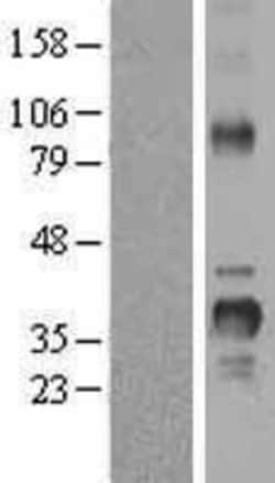 Novus Biologicals&trade;&nbsp;Cyclin D2 Overexpression Lysate