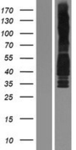 Novus Biologicals&trade;&nbsp;Cyclin D3 Overexpression Lysate