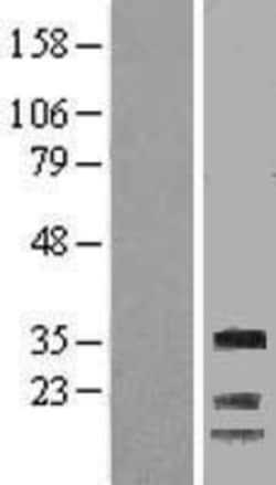 Novus Biologicals&trade;&nbsp;Cyclin G Overexpression Lysate