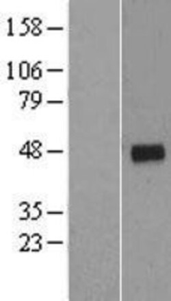 Novus Biologicals&trade;&nbsp;Cyclin G2 Overexpression Lysate