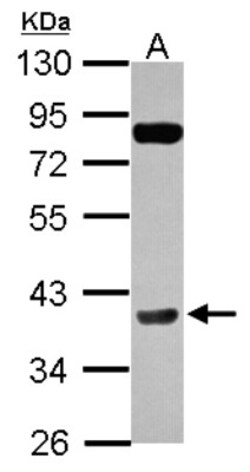 anti-Cyclin H, Polyclonal, Novus Biologicals 0.1mL; Unlabeled:Antibodies,