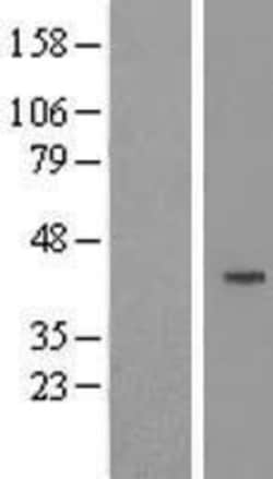 Novus Biologicals&trade;&nbsp;Cyclin J Overexpression Lysate