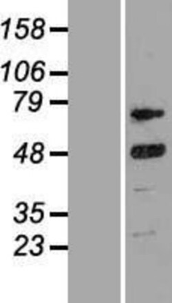 Novus Biologicals™ Cyclin T2 Overexpression Lysate