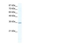 Cyclin G2 Antibody, Novus Biologicals 100 &mu;L | Buy Online | Novus Biologicals | Fisher Scientific
