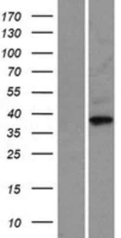 Novus Biologicals&trade;&nbsp;Cyclin-O Overexpression Lysate