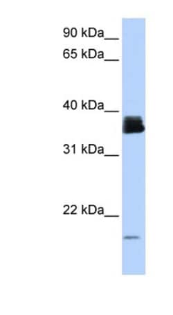 Cyclophilin A Antibody, Novus Biologicals 0.05mg; Unlabeled:Antibodies,