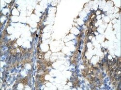 Cyclophilin A Antibody, Novus Biologicals 0.1mg; Unlabeled:Antibodies,