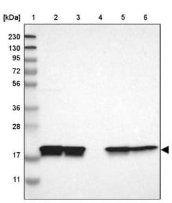 Cyclophilin B Antibody, Novus Biologicals 25 &mu;L; Unlabeled:Antibodies,