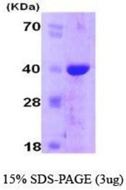 Novus Biologicals&trade;&nbsp;Recombinant Human Cyclophilin-E His Protein