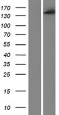 Novus Biologicals&trade;&nbsp;CYFIP1 Overexpression Lysate