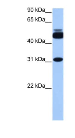 CYLC2 Antibody, Novus Biologicals 0.05mg; Unlabeled:Antibodies, Polyclonal