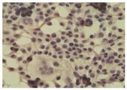 CYLD Antibody, Novus Biologicals:Antibodies:Primary Antibodies