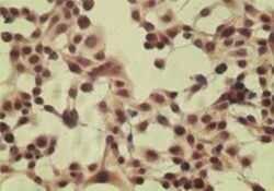 CYLD Antibody, Novus Biologicals:Antibodies:Primary Antibodies