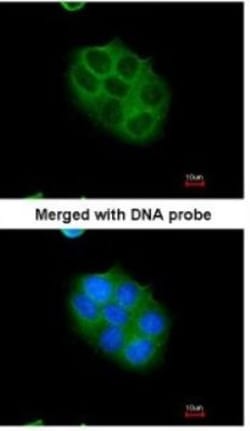 CYLD Antibody, Novus Biologicals 0.1mg; Unlabeled:Antibodies, Polyclonal