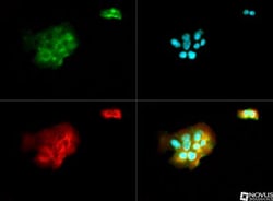 CYLD Antibody, Novus Biologicals:Antibodies:Primary Antibodies