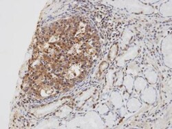 CYLD Antibody, Novus Biologicals 0.1mg; Unlabeled:Antibodies, Polyclonal