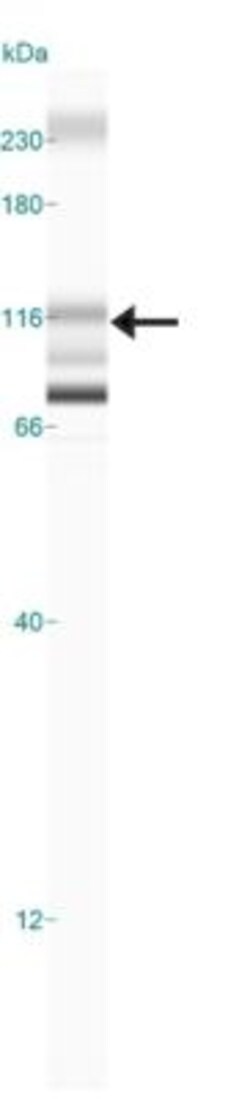 CYLD Antibody, Novus Biologicals:Antibodies:Primary Antibodies
