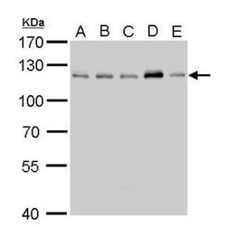 CYLD Antibody, Novus Biologicals 0.1mg; Unlabeled:Antibodies, Polyclonal