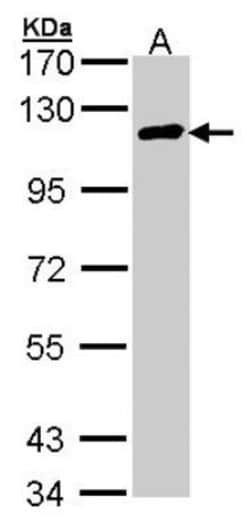 CYLD Antibody, Novus Biologicals 0.1mg; Unlabeled:Antibodies, Polyclonal