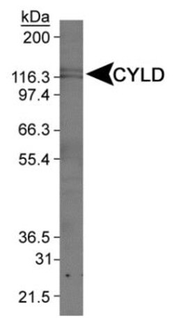CYLD Antibody, Novus Biologicals:Antibodies:Primary Antibodies
